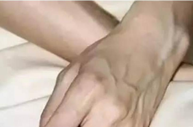 1000090721