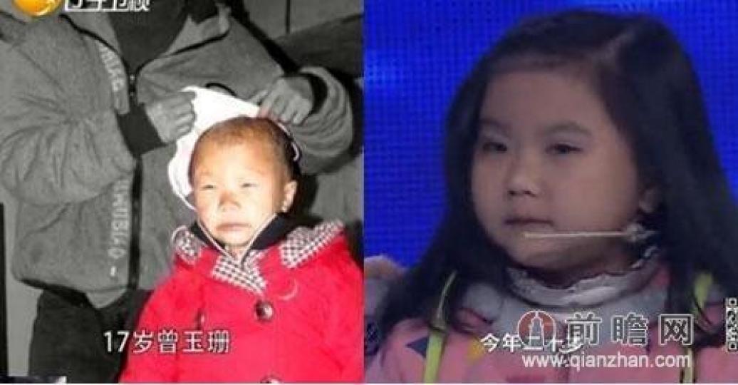 四川姑娘曾玉姍,出生
於1 994年,7歲時發病
未老先衰逆生長,變回
了一個2歲嬰孩,後來
去北京治病切除腦部
腫瘤,身體有所改變，
但面容和身高還是象
個小孩...