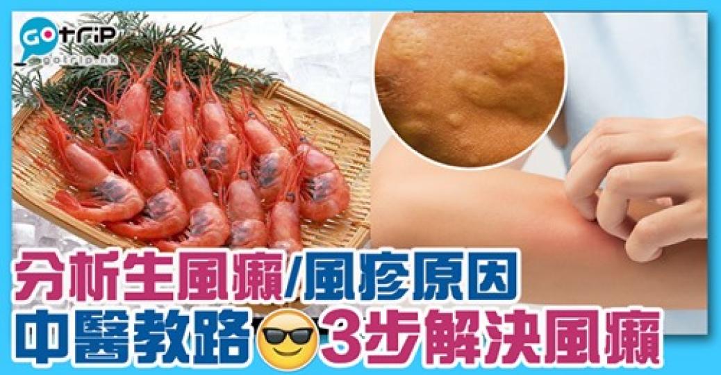 如果生風癩可以試下呢啲方法，詳情：gotrip.hk/496742/...
