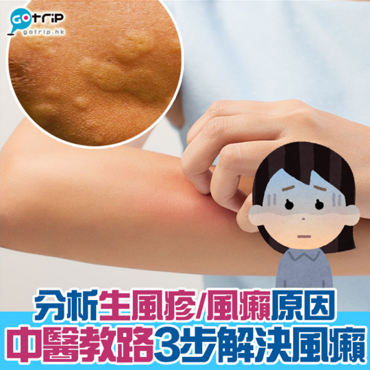 大家如果生風癩，可以試下有冇效！詳情：gotrip.hk/496742...