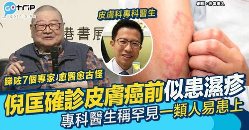 倪匡先生2019年公開提及自己患有皮膚病...