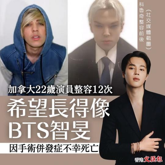 加拿大22歲演員整容12次 希望長得像BTS智旻  因手術併發症死亡...