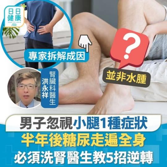 可能代表糖尿已走勻全身...