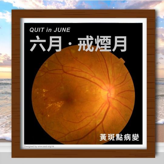 吸煙加速視力衰退 ......