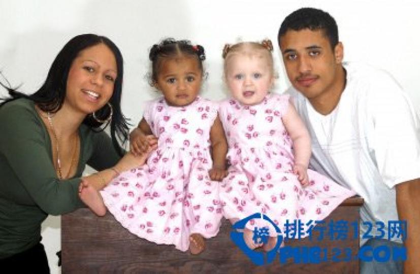 早前英國一對混血雙胎姐妹渡
過1歲生日,剛出生時兩人幾乎
一模一樣,一天天長大,姐膚色
雪白金黃捲髮,碧藍大眼睛，
妹則黑膚色和黑頭髮,黑白膚
色雙胞胎專家説非常罕見,發
生率僅有百萬分之一。...