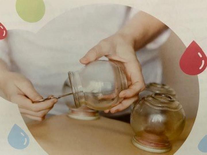 拔罐
拔罐是一種起源於古中國的保健療法,是將杯子(罐子)在皮膚上以產生吸力。抽吸可以促進血液流動的癒合。許多人士認為拔罐有助於平衡體內的陰陽。恢復這兩個極端之間的平衡,被認為有助於提高身體對病原體的... 拔罐
拔罐是一種起源於古中國的保健療法,是將杯子(罐子)在皮膚上以產生吸力。抽吸可以促進血液流動的癒合。許多人士認為拔罐有助於平衡體內的陰陽。恢復這兩個極端之間的平衡,被認為有助於提高身體對病原體的...