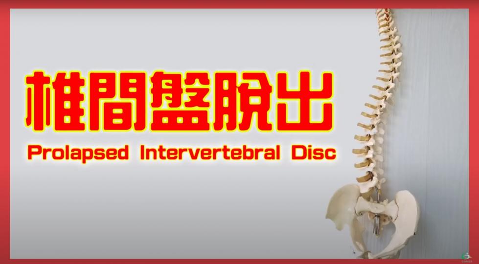 腰背痛之椎間盤脫出Prolapsed Intervertebral Disc【傷患痛症系列】
