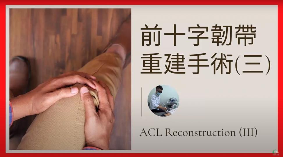 前十字韌帶重建手術（三）ACL Reconstruction【傷患痛症系列】