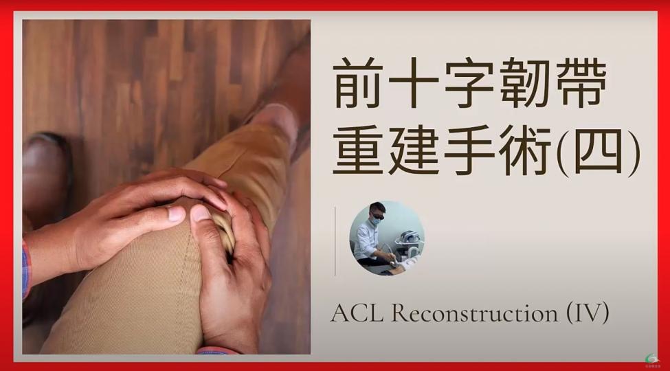 前十字韌帶重建手術（四）ACL Reconstruction【傷患痛症系列】