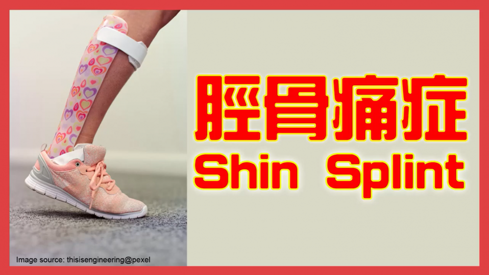 腳痛之脛骨痛症 腳痛之脛骨痛症