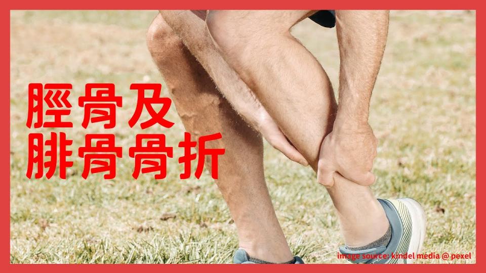 【傷患痛症系列】腳痛之脛骨及腓骨骨折