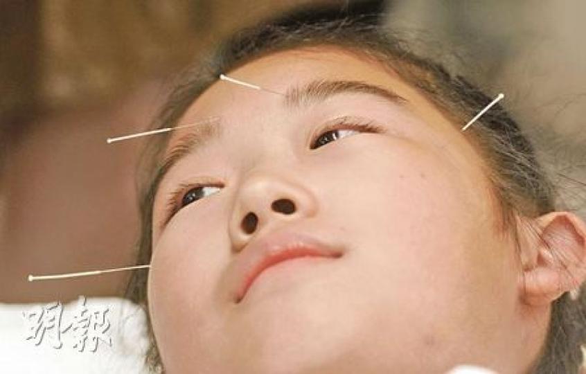 13歲的李少僑4年前接受針灸治療，她說第一次針灸時「心裏有點害怕」，但經過1至2次後就慢慢不怕。現在她的視力已完全恢復正常。 （尹錦恩攝）