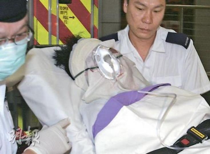 男子在睡夢中被妻子用腐液潑淋，送院時需用敷料覆臉，以防細菌感染。（胡永輝攝）