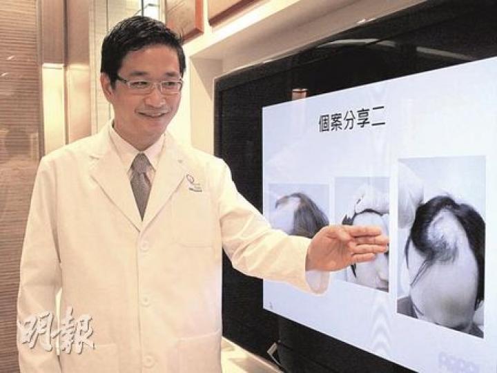 皮膚科專科醫生侯嘉林指出,陳先生(個案事主)16歲就讀中四時,髮型師告訴他髮線已開始後移,後來頭髮愈來愈薄,20歲就讀大學一年級時求診,當時在病情已達第四期「雄禿」(如圖)。(曾愛盈攝) 皮膚科專科醫生侯嘉林指出,陳先生(個案事主)16歲就讀中四時,髮型師告訴他髮線已開始後移,後來頭髮愈來愈薄,20歲就讀大學一年級時求診,當時在病情已達第四期「雄禿」(如圖)。(曾愛盈攝)