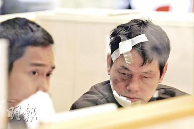 姓翟的士司機無辜被醉酒乘客襲擊,額頭和口角受傷,眼眶瘀黑,更損失大半晚收入,送院接受治療時一臉無奈。(蔡方山攝)醉酒男子乘的士期間失常,多次箍司機頸,又咬傷司機嘴,導致的士在九龍城失事撞欄,幸未有鬧出人命。(蔡方山攝) 姓翟的士司機無辜被醉酒乘客襲擊,額頭和口角受傷,眼眶瘀黑,更損失大半晚收入,送院接受治療時一臉無奈。(蔡方山攝)醉酒男子乘的士期間失常,多次箍司機頸,又咬傷司機嘴,導致的士在九龍城失事撞欄,幸未有鬧出人命。(蔡方山攝)