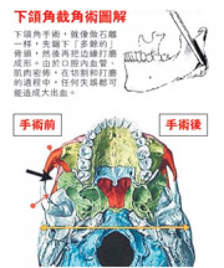 (明報製圖) (明報製圖)