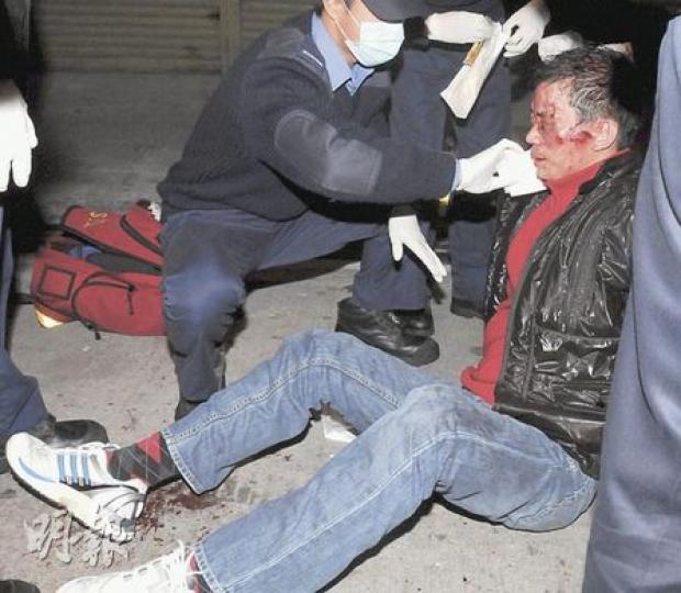酒吧東主在消夜後遭人伏擊，被人用水喉鐵通扑傷頭部。（蔡方山攝）酒吧東主遇襲後，其妻驚魂未定。（蔡方山攝）