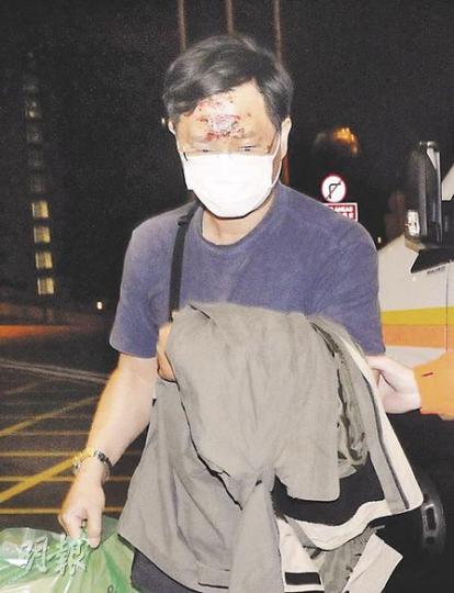 一名在山東遇上車禍的港人，昨凌晨返港後被送往瑪嘉烈醫院治理，額頭遺下大幅傷痕。（蔡方山攝）