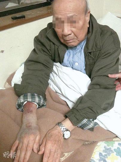 羅伯原本入仁濟醫院檢查大腸，但其後醫生要求輸血，詎料疑因護士出錯「拮」錯針，令他的右手即時變得腫脹兼呈現瘀傷。（明報記者攝） 據昨日現場觀察，仁濟醫院外科病房入住率只有三分之一，但有病人家屬批評有護士未有理會病人需要，亦有家屬指護士「叫極不應」。（明報記者攝）