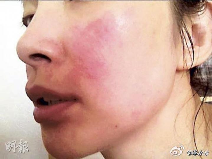 (微博圖片) (微博圖片)