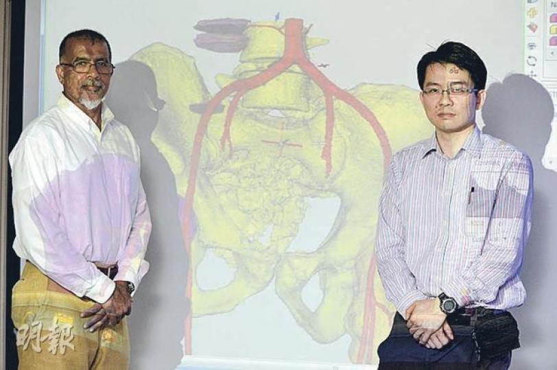 中大矯形外科及創傷學系教授古明達(左)與名譽臨牀助理教授黃國全(右),與病人Kelvin盆骨的3D圖像合照。(何家達攝) 中大矯形外科及創傷學系教授古明達(左)與名譽臨牀助理教授黃國全(右),與病人Kelvin盆骨的3D圖像合照。(何家達攝)