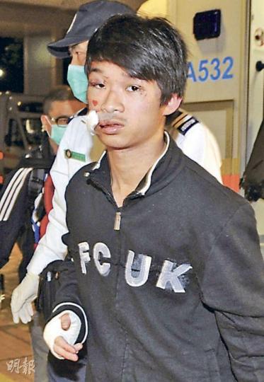 在意外中受傷的港人,大部分於昨晚返港。圖為右手及嘴角受傷的傷者昨晚送抵威爾斯親王醫院。(衛永康攝) 在車禍中受傷的港人許女士,昨晚仍於當地彭湃醫院留醫。(伍蒲鋒攝) 在意外中受傷的港人,大部分於昨晚返港。圖為右手及嘴角受傷的傷者昨晚送抵威爾斯親王醫院。(衛永康攝) 在車禍中受傷的港人許女士,昨晚仍於當地彭湃醫院留醫。(伍蒲鋒攝)