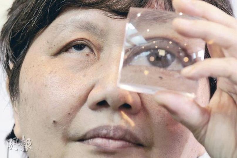 失明了15年的曾胡雪婉今年2月參與國際研究,成為首個亞洲區的病人,右眼獲植入價值近100萬元的晶片重見光明。她手持的透明立方體中央放置了類近的晶片,大小只得3平方毫米。(郭慶輝攝) 失明了15年的曾胡雪婉今年2月參與國際研究,成為首個亞洲區的病人,右眼獲植入價值近100萬元的晶片重見光明。她手持的透明立方體中央放置了類近的晶片,大小只得3平方毫米。(郭慶輝攝)