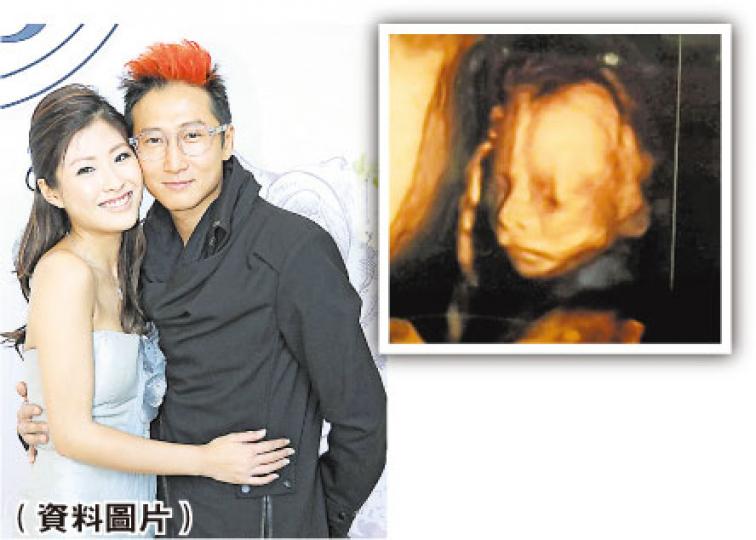 BB鼻樑高高,大家覺得似爸爸洪天明?還是媽咪周家蔚呢?(微博圖片) BB鼻樑高高,大家覺得似爸爸洪天明?還是媽咪周家蔚呢?(微博圖片)