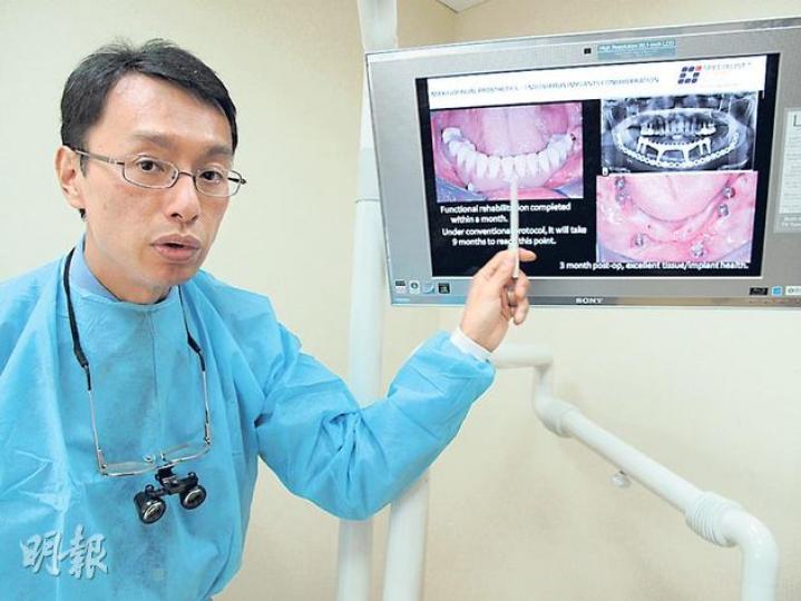 在新加坡發展牙醫業務已8年的港產牙醫鄭智聰,是口腔修復專家,部分癌症病人切除腫瘤時,若要將牙骨也鋸走,他也能透過駁骨手術重修牙齒,讓病人回復昔日容貌。(陳佩儀攝) 在新加坡發展牙醫業務已8年的港產牙醫鄭智聰,是口腔修復專家,部分癌症病人切除腫瘤時,若要將牙骨也鋸走,他也能透過駁骨手術重修牙齒,讓病人回復昔日容貌。(陳佩儀攝)