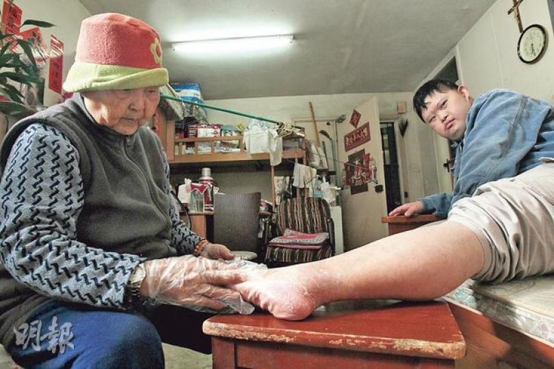 陳婆婆（左）多年來獨力照顧患唐氏綜合症的兒子志彬（右），年屆九旬的她牢牢記着志彬要服食的藥，又細心為他塗藥膏。雖然照顧吃力，但兩母子不時互相作弄，苦中作樂。（林俊源攝）