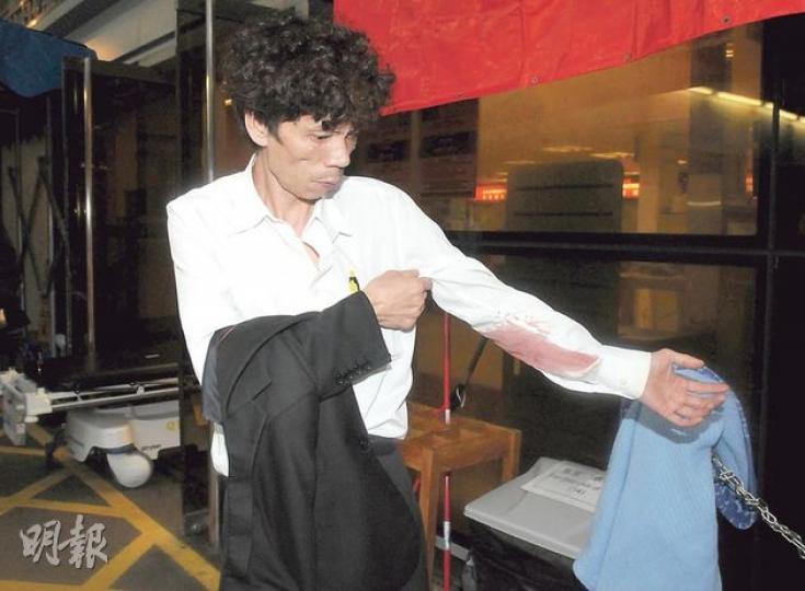 失業漢賭輸錢復遭露宿者用木棍毆傷，事後展示傷勢。（蔡方山攝）油麻地佐治五世公園傷人案現場，仍有大量露宿者雜物，而引起今次風波的牀褥仍放在一旁。（蔡方山攝）