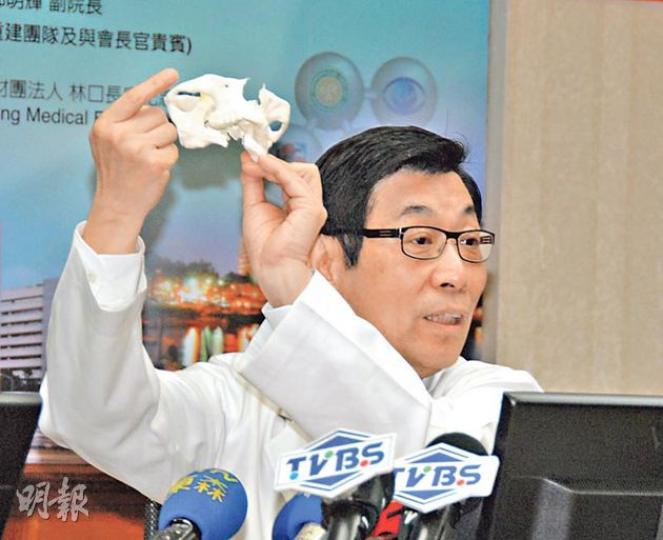 主診醫生魏福全舉起易小玲口腔的3D模型講解手術詳情，他指手術成功，若康復進度理想，4至6個月後便可以為易小玲植牙。（曾映妹攝）