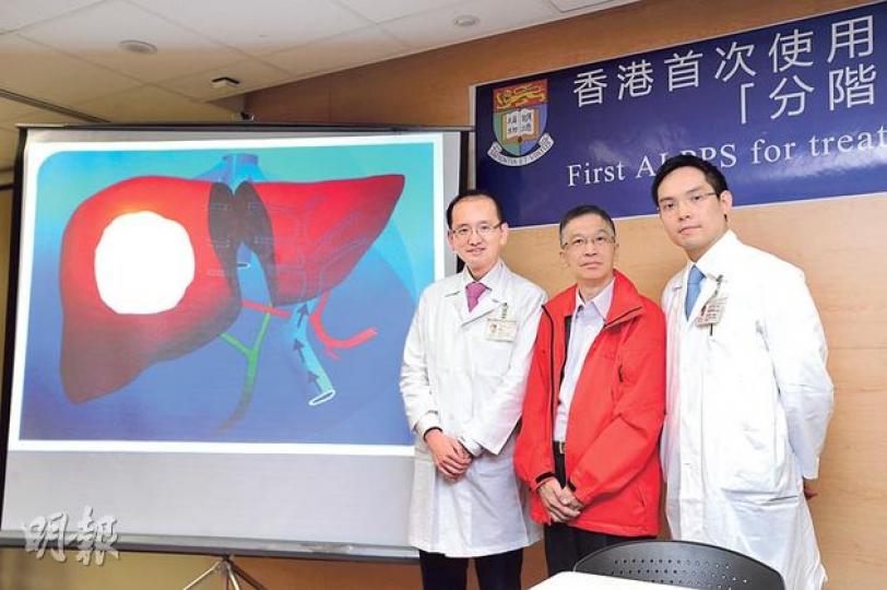 瑪麗醫院去年起引入新的肝切除手術令更多病人受惠,62歲的患者招先生(中)右肝曾有一個13厘米大的腫瘤,輾轉向港大肝膽胰外科主任潘冬平(左)求醫並接受手術,左肝增生後由原來佔全肝26%增至34%。右為港大肝膽胰外科臨牀助理教授陳智仁。(胡景禧攝)(明報製圖) 瑪麗醫院去年起引入新的肝切除手術令更多病人受惠,62歲的患者招先生(中)右肝曾有一個13厘米大的腫瘤,輾轉向港大肝膽胰外科主任潘冬平(左)求醫並接受手術,左肝增生後由原來佔全肝26%增至34%。右為港大肝膽胰外科臨牀助理教授陳智仁。(胡景禧攝)(明報製圖)