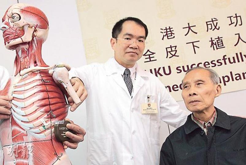 港大上月進行全亞洲首宗全皮下心臟除顫器手術，患者為年屆76歲的楊伯伯（右），他數月前因舊除顫器引發細菌感染，故要接受新手術；新除顫器置於左肋骨旁，接駁電極線只需經胸骨伸入皮膚下，毋須通過血管及心臟。左為港大內科學系臨牀副教授蕭頌華。（李澤彤攝）（明報製圖）