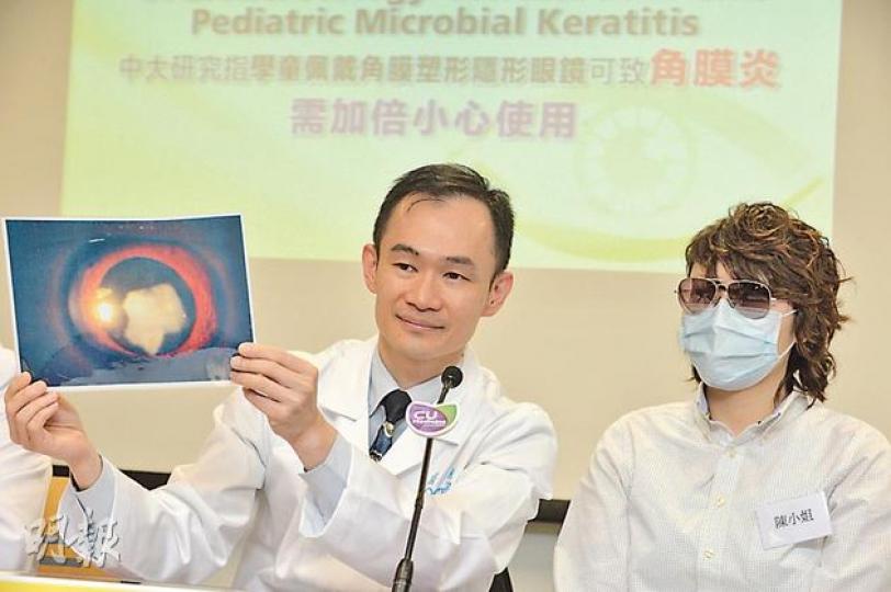 中大眼科及視覺科學學系榮譽臨牀副教授楊樂旼（左）手持一名3歲小童的眼部相片，解說戴隱形眼鏡及OK鏡可導致角膜潰瘍及永久留下白色疤痕。20餘歲的陳小姐（右）因童年戴OK鏡致左眼角膜潰瘍，現時只能靠500度近視的右眼視物。（盧翊銘攝）