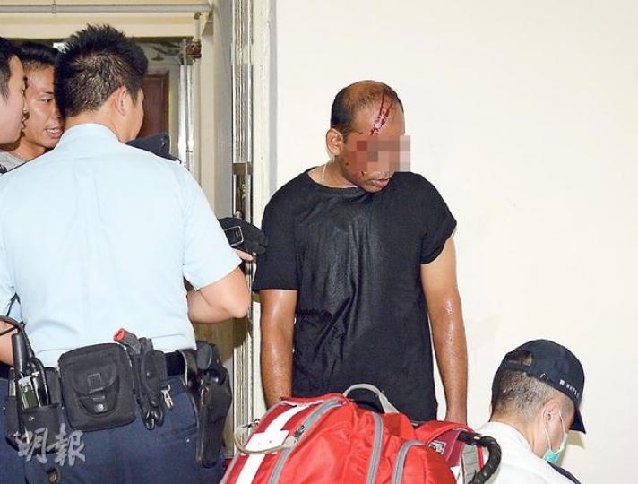 涉嫌劫財劫色後被街坊合力擒獲的南亞漢,糾纏間遭人以硬物擊至頭破血流及右眼瘀腫,被捕後需送院治理。(蔡方山攝) 涉嫌劫財劫色後被街坊合力擒獲的南亞漢,糾纏間遭人以硬物擊至頭破血流及右眼瘀腫,被捕後需送院治理。(蔡方山攝)