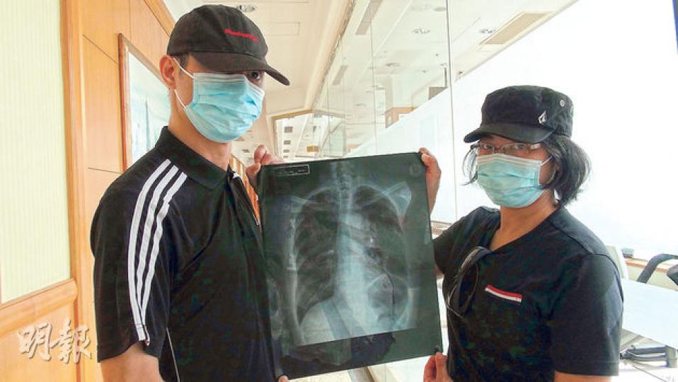 向威爾斯醫院求診的節儉慈母,未被診斷出肺癌,她的女兒張家寶(右)與男親友展示4月在私家診所檢查所照的X光片,當時她已被確定為末期肺癌。(林智傑攝)(明報製圖) 向威爾斯醫院求診的節儉慈母,未被診斷出肺癌,她的女兒張家寶(右)與男親友展示4月在私家診所檢查所照的X光片,當時她已被確定為末期肺癌。(林智傑攝)(明報製圖)