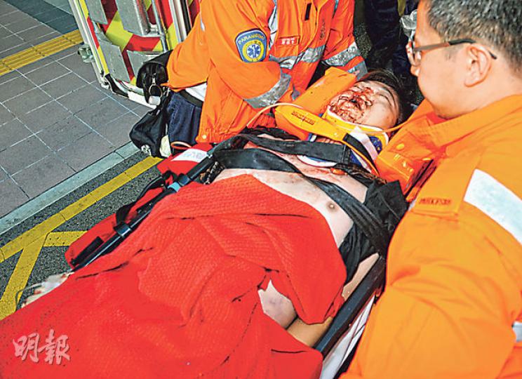 23歲平治房車司機疑頭撼軚盤,事後口鼻噴血,面部凹陷,送院搶救後不治。(蔡方山攝)平治房車高速撞向停在快線的箭嘴燈車,因箭嘴燈車已收起車尾緩衝防撞架(箭嘴示),平治房車車頭直插箭嘴燈車底部,如同廢鐵,平治司機有車內氣袋保護仍告斃命。(蔡方山攝) 23歲平治房車司機疑頭撼軚盤,事後口鼻噴血,面部凹陷,送院搶救後不治。(蔡方山攝)平治房車高速撞向停在快線的箭嘴燈車,因箭嘴燈車已收起車尾緩衝防撞架(箭嘴示),平治房車車頭直插箭嘴燈車底部,如同廢鐵,平治司機有車內氣袋保護仍告斃命。(蔡方山攝)