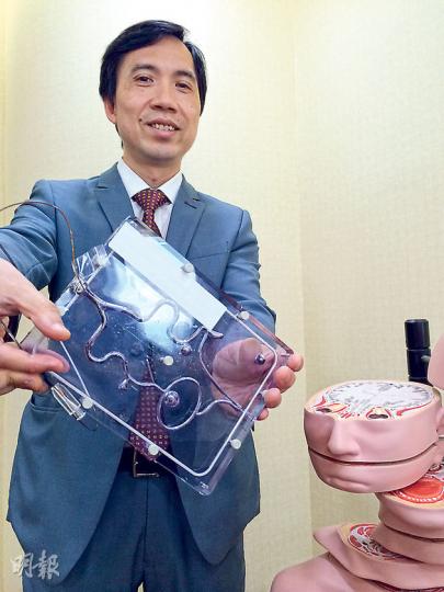 神經外科專科醫生鄭建明(圖)展示顱內動脈瘤模型,指現今主要以可重複進行的微創導管動脈瘤栓塞手術治療患者,醫生會將鉑金線圈沿導管輸送至動脈瘤位置,讓血液無法流進,達控制出血的效果。(陳顥之攝) 神經外科專科醫生鄭建明(圖)展示顱內動脈瘤模型,指現今主要以可重複進行的微創導管動脈瘤栓塞手術治療患者,醫生會將鉑金線圈沿導管輸送至動脈瘤位置,讓血液無法流進,達控制出血的效果。(陳顥之攝)