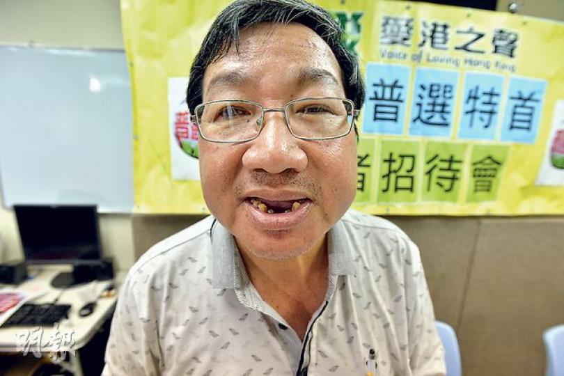 愛港之聲主席高達斌因為一粒欖核唔見咗5隻牙同十幾萬,下個月就會去補牙,但就唔會鑲金牙。(鄧宗弘攝) 愛港之聲主席高達斌因為一粒欖核唔見咗5隻牙同十幾萬,下個月就會去補牙,但就唔會鑲金牙。(鄧宗弘攝)