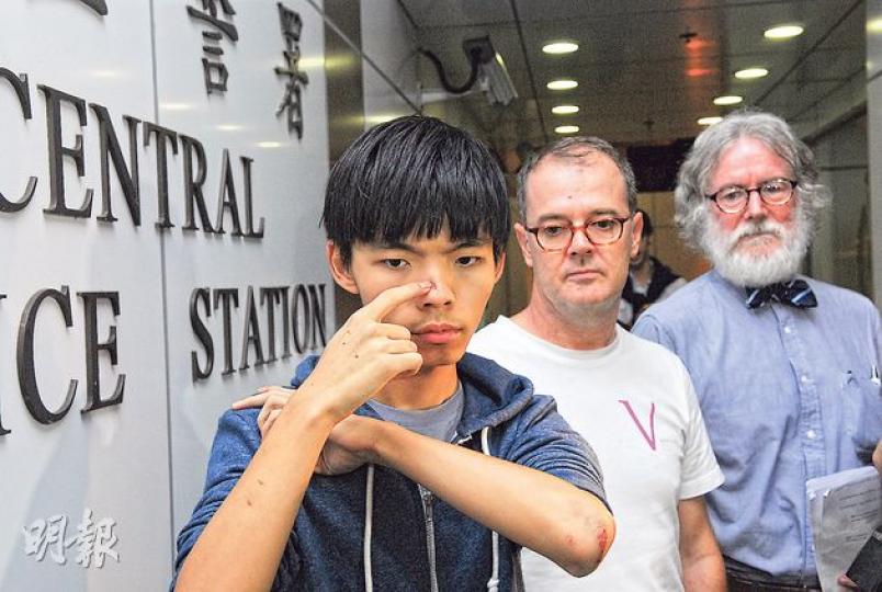 學民思潮召集人黃之鋒(左)昨晚獲高等法院批出人身保護令,無條件獲釋,晚上約8時半離開中區警署,共被警方扣留約46小時。黃之鋒以手指指示前晚被警方扣捕時留下的傷勢。他說休息過後,會與學界繼續並肩作戰。旁為黃的代表律師韋智達(中)及麥嘉汶(右)。(鍾炳然攝) 學民思潮召集人黃之鋒(左)昨晚獲高等法院批出人身保護令,無條件獲釋,晚上約8時半離開中區警署,共被警方扣留約46小時。黃之鋒以手指指示前晚被警方扣捕時留下的傷勢。他說休息過後,會與學界繼續並肩作戰。旁為黃的代表律師韋智達(中)及麥嘉汶(右)。(鍾炳然攝)