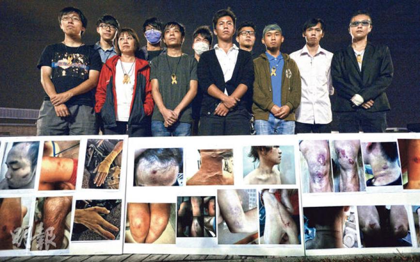 警方於10月15日凌晨在龍和道清場行動中拘捕45人,其中10多人昨在金鐘「暗角」舉行記者會,展示傷勢相片。被捕者之一、任職補習教師的彭先生(右)稱,其左手被警察「屈手」致受傷(橫額上排左三)、頸有瘀傷(橫額上排左六)等。(余俊亮攝) 警方於10月15日凌晨在龍和道清場行動中拘捕45人,其中10多人昨在金鐘「暗角」舉行記者會,展示傷勢相片。被捕者之一、任職補習教師的彭先生(右)稱,其左手被警察「屈手」致受傷(橫額上排左三)、頸有瘀傷(橫額上排左六)等。(余俊亮攝)