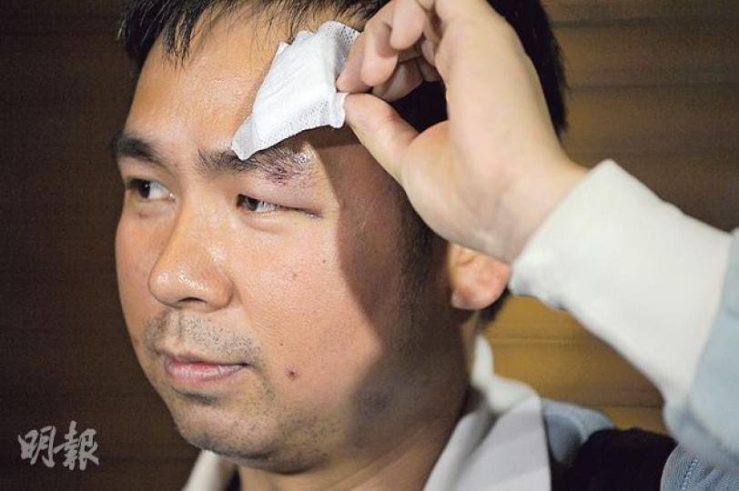 now新聞台工程人員李小龍(圖)今日零時30分左右獲無條件釋放,他指被捕期間曾遭人腳踢及按在地上,因而受傷,他獲釋時揭開左額的紗布,展示部分傷痕。(鄧宗弘攝) now新聞台工程人員李小龍(圖)今日零時30分左右獲無條件釋放,他指被捕期間曾遭人腳踢及按在地上,因而受傷,他獲釋時揭開左額的紗布,展示部分傷痕。(鄧宗弘攝)