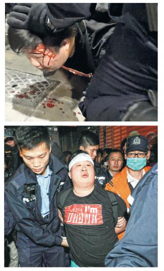 警方在昨日凌晨旺角流動佔領行動中拘捕10男2女,其中在山東街通菜街交界,有被捕示威青年頭部受傷(上圖),現場包紮後由警押解送院(下圖)。(蔡方山攝) 警方在昨日凌晨旺角流動佔領行動中拘捕10男2女,其中在山東街通菜街交界,有被捕示威青年頭部受傷(上圖),現場包紮後由警押解送院(下圖)。(蔡方山攝)