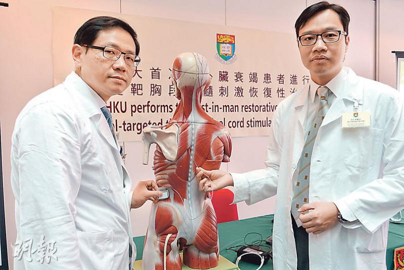 港大醫學院內科學系講座教授謝鴻發(左)指出,植入刺激器手術成本為15萬至20萬元,要確定療法的成效,需要最少100個臨牀個案。港大麻醉學系臨牀副教授張志偉(右)指手術只需局部麻醉,風險較需全身麻醉的換心手術低。(陳顥之攝) 港大醫學院內科學系講座教授謝鴻發(左)指出,植入刺激器手術成本為15萬至20萬元,要確定療法的成效,需要最少100個臨牀個案。港大麻醉學系臨牀副教授張志偉(右)指手術只需局部麻醉,風險較需全身麻醉的換心手術低。(陳顥之攝)