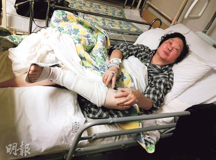 巴士爆胎意外中,68歲潘姓外婆保護5歲外孫女免被碎片擊傷,自己則被「炸傷」左腿。(伍浦鋒攝)朱女士向記者展示腿部傷勢,她估計康復後需要再過3至4個月才能落地走路,擔心會因而失業,對日後乘巴士亦有恐懼,會向巴士公司追討賠償。(伍浦鋒攝) 巴士爆胎意外中,68歲潘姓外婆保護5歲外孫女免被碎片擊傷,自己則被「炸傷」左腿。(伍浦鋒攝)朱女士向記者展示腿部傷勢,她估計康復後需要再過3至4個月才能落地走路,擔心會因而失業,對日後乘巴士亦有恐懼,會向巴士公司追討賠償。(伍浦鋒攝)