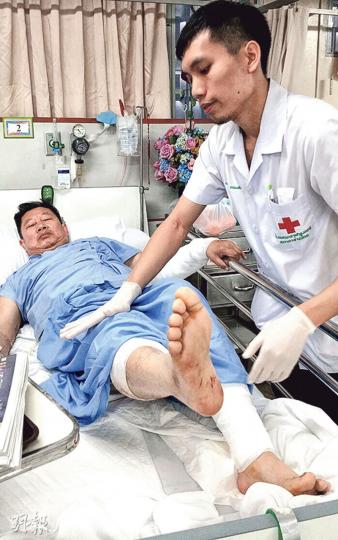 62歲港人朱日安雙腳嚴重受傷，至今未能落地的他表示爆炸當日「只知要拖住太太快點走」，而不知道自己受傷。（曾映妹攝）