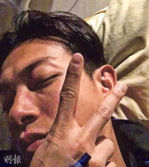 梁烈唯擺出V字手勢,希望手術順利。(微博圖片)梁烈唯入院做眼部手術,在醫院玩自拍。(微博圖片) 梁烈唯擺出V字手勢,希望手術順利。(微博圖片)梁烈唯入院做眼部手術,在醫院玩自拍。(微博圖片)