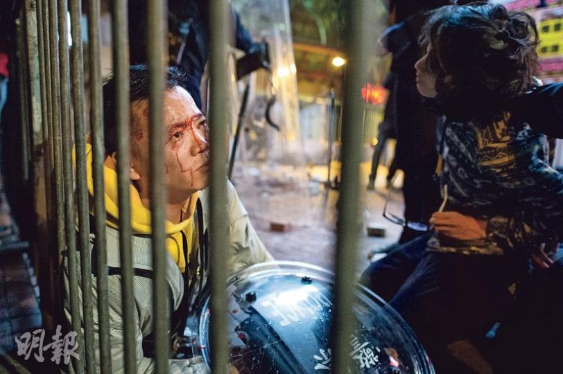 任職油尖旺區警民關係主任的黃姓警員，在衝突中被示威者以磚頭掟中臉頰，血流披臉，一度昏迷，今日要做手術清除臉頰碎骨。現場所見，他身穿便服執勤，沒有保護衣物。（鄧宗弘攝）旺角的警民衝突愈夜愈烈，警方幾度揮動警棍嘗試驅散示威者，推撞期間一名示威者遭警棍擊中，倒臥在地血流如注，連眼睛也幾近睜不開，他被制服後有警員用紙巾為他止血。（馮凱鍵攝）旺角警民衝突場面混亂，衝突雙方都有不少人受傷，昨早有示威者被警棍擊中（圖），血流披面，由兩名警員帶走。（李紹昌攝）