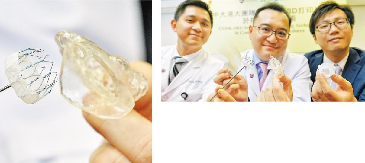中大醫學院內科及藥物治療學系心臟科助理教授李沛威(中)表示,利用3D打印技術製造病人左心耳實體矽膠模型(左圖右)後,再用導管將堵塞器(左圖左)放在模型,模擬手術情况,有助增加手術準確度。上圖左為該系心臟科名譽臨牀助理教授張誠謙,右為研發系統的港大工程學院機械工程系助理教授郭嘉威。(楊柏賢攝) 中大醫學院內科及藥物治療學系心臟科助理教授李沛威(中)表示,利用3D打印技術製造病人左心耳實體矽膠模型(左圖右)後,再用導管將堵塞器(左圖左)放在模型,模擬手術情况,有助增加手術準確度。上圖左為該系心臟科名譽臨牀助理教授張誠謙,右為研發系統的港大工程學院機械工程系助理教授郭嘉威。(楊柏賢攝)